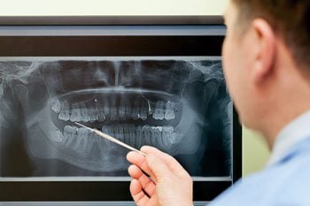 person looking at an XRay